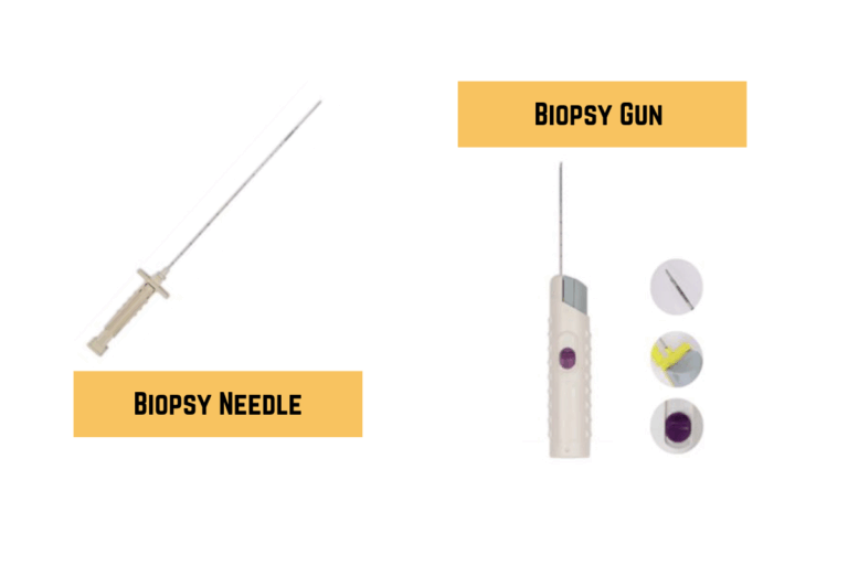 When and Why Kidney Biopsies Are Performed: The Role of Biopsy Needles and Biopsy Guns
