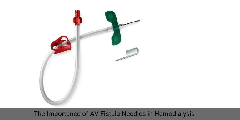 The Role of AV Fistula Needles in Achieving Optimal Blood Flow for Hemodialysis
